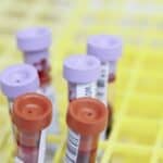 Home Blood Tests: Revolutionizing Personal Health Monitoring