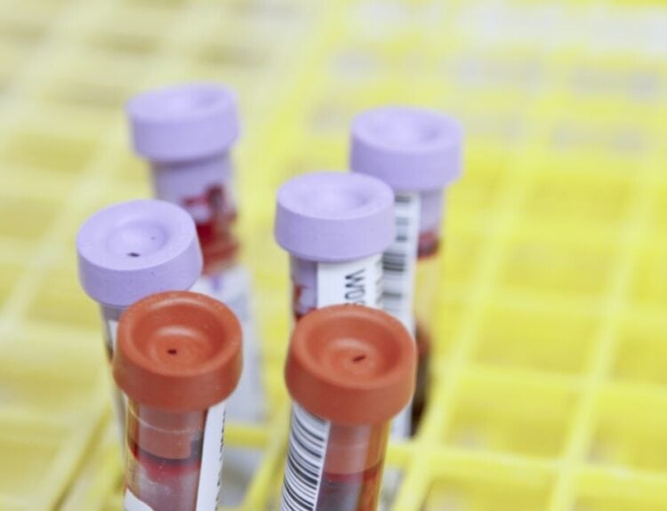 Home Blood Tests: Revolutionizing Personal Health Monitoring